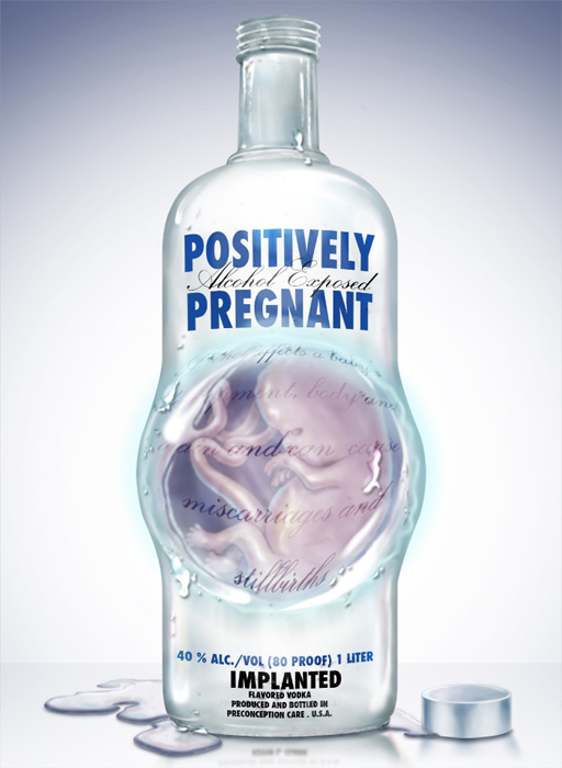Alcohol exposed pregnancy medical illustration