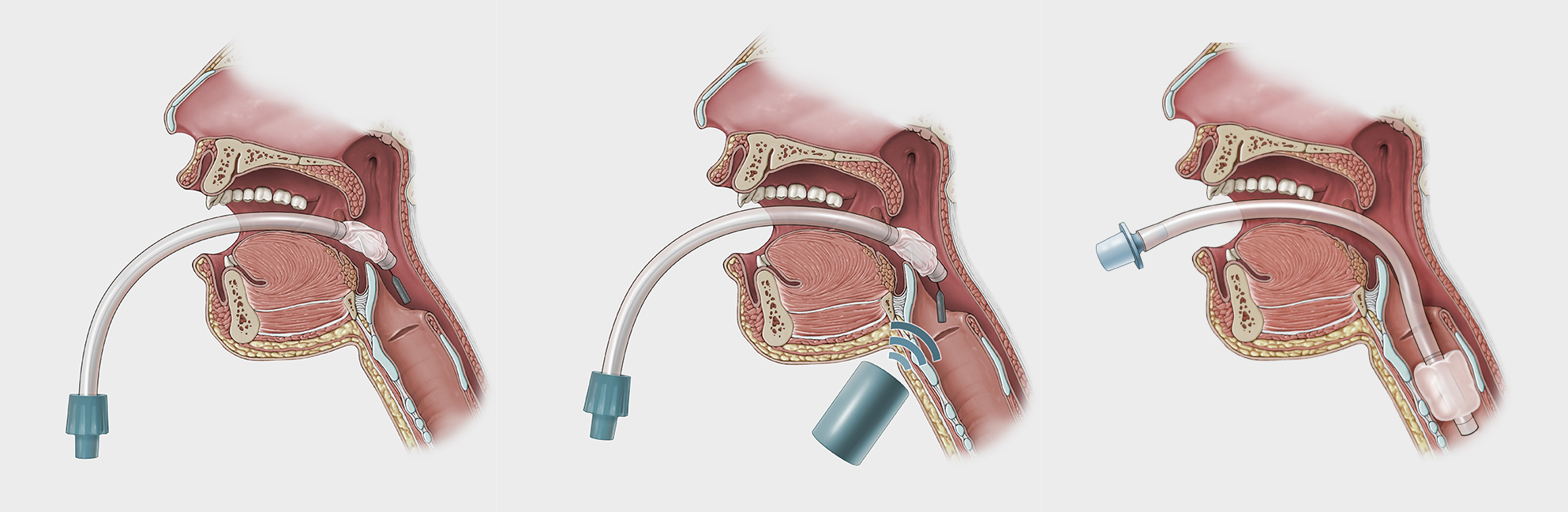 GaTech illustration sequence